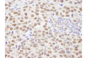 Immunohistochemistry (IHC) image for anti-Protein Phosphatase, Mg2+/Mn2+ Dependent, 1G (PPM1G) (AA 400-450) antibody (ABIN7448735)