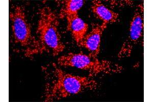 Proximity Ligation Assay (PLA) image for anti-Amyloid beta (A4) Precursor Protein (APP) (AA 19-305) antibody (ABIN559905)