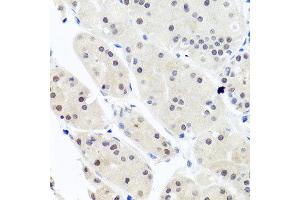 Immunohistochemistry of paraffin-embedded human stomach using HNRNPCL1 antibody at dilution of 1:100 (x40 lens).