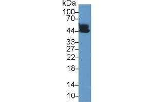 Detection of a1AGP in Human Lung lysate using Polyclonal Antibody to Alpha-1-Acid Glycoprotein (a1AGP) (ORM1 Antikörper  (AA 19-201))