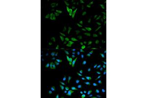 Immunofluorescence analysis of HeLa cells using ENO1 antibody. (ENO1 Antikörper)