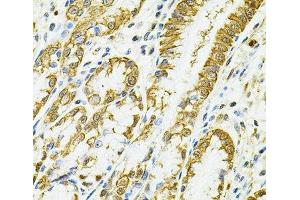 Immunohistochemistry (Paraffin-embedded Sections) (IHC (p)) image for anti-Major Histocompatibility Complex, Class II, DQ alpha 1 (HLA-DQA1) antibody (ABIN7260259)