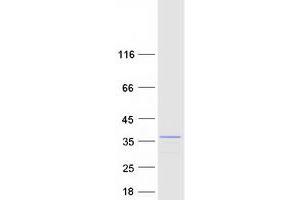 Western Blotting (WB) image for Exosome Component 2 (EXOSC2) protein (Myc-DYKDDDDK Tag) (ABIN2731213)