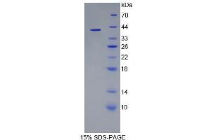 Image no. 1 for Phosphodiesterase 1A (PDE1A) (AA 2-318) protein (His tag) (ABIN6237460)