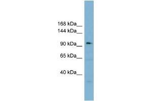 WB Suggested Anti-SART3 Antibody Titration:  0. (SART3 Antikörper  (Middle Region))
