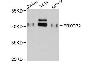Western blot analysis of extracts of various cell lines, using FBXO32 antibody (ABIN2562558) at 1:1000 dilution.