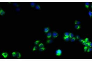 Immunofluorescence staining of PC-3 cells with ABIN7171386 at 1:53, counter-stained with DAPI. (CD3 epsilon Antikörper  (AA 23-207))