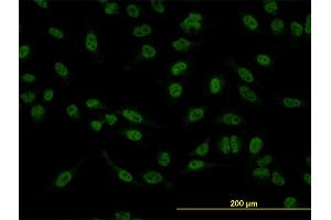 Immunofluorescence of monoclonal antibody to SMAD5 on HeLa cell. (SMAD5 Antikörper  (AA 105-182))
