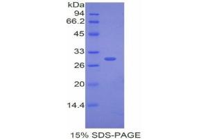 SDS-PAGE (SDS) image for Cholesteryl Ester Transfer Protein (CETP) (AA 232-487) protein (His tag) (ABIN1525387)