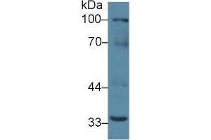 Western blot analysis of Mouse Liver lysate, using Mouse RANk Antibody (2 µg/ml) and HRP-conjugated Goat Anti-Rabbit antibody ( (TNFRSF11A Antikörper  (AA 359-542))