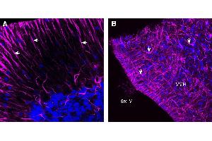 Expression of GFAP in rat cerebellum and hypothalamus.
