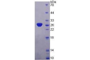 SDS-PAGE analysis of SNAP25 Protein.