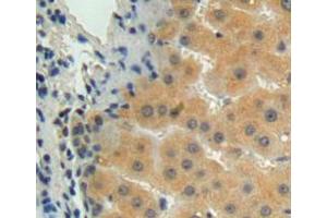 Used in DAB staining on fromalin fixed paraffin-embedded liver tissue (MMP15 Antikörper  (AA 280-497))