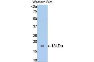 Detection of Recombinant LIFR, Rat using Polyclonal Antibody to Leukemia Inhibitory Factor Receptor (LIFR) (LIFR Antikörper  (AA 151-290))
