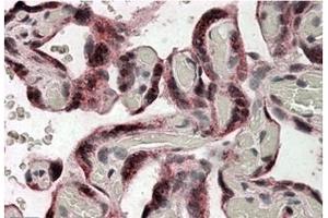 Image no. 1 for anti-Iduronate 2-Sulfatase (IDS) (Internal Region) antibody (ABIN375037) (IDS Antikörper  (Internal Region))