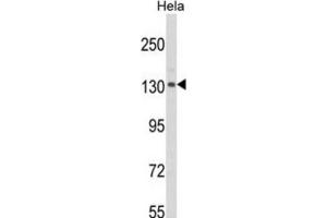 Western Blotting (WB) image for anti-CAP-GLY Domain Containing Linker Protein 1 (CLIP1) antibody (ABIN3003978)