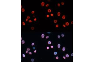 Immunofluorescence analysis of HeLa cells using CDKN1A/p21CIP1 antibody (ABIN3022005, ABIN3022006, ABIN3022007 and ABIN6218565) at dilution of 1:100.