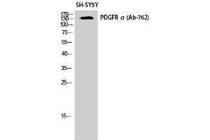 Western Blotting (WB) image for anti-Platelet Derived Growth Factor Receptor alpha (PDGFRA) (Thr210) antibody (ABIN3186366) (PDGFRA Antikörper  (Thr210))