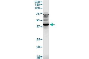 CADM1 polyclonal antibody (A01), Lot # UOZ1060607QCS1. (CADM1 Antikörper  (AA 151-250))