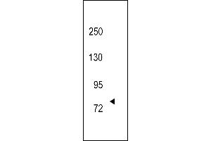 Western Blotting (WB) image for anti-Neurotrophic tyrosine Kinase, Receptor, Type 3 (NTRK3) (AA 31-61), (N-Term) antibody (ABIN392066)