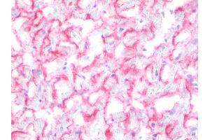 anti-Sarcoglycan, beta (43kDa Dystrophin-Associated Glycoprotein) (SGCB) (AA 1-319) antibody