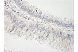 Immunohistochemistry (IHC) image for anti-Cullin 3 (CUL3) (AA 650-700) antibody (ABIN7448504) (Cullin 3 Antikörper  (AA 650-700))