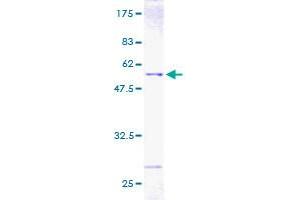 EIF4E Protein (AA 1-217) (GST tag)