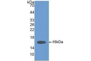 Detection of Recombinant HPA, Mouse using Polyclonal Antibody to Heparanase (HPSE) (HPSE Antikörper  (AA 280-412))