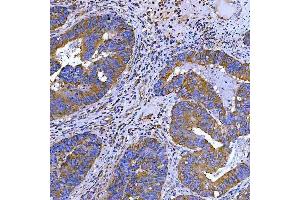 IHC analysis of SWAP70 using anti-SWAP70 antibody (ABIN7600201). (SWAP70 Antikörper  (AA 161-292))