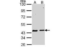 WB Image Sample (30 ug of whole cell lysate) A: A549 B: Hela 10% SDS PAGE antibody diluted at 1:1000 (SERPINB6 Antikörper  (Internal Region))