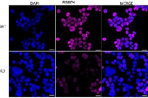Immunocytochemical staining of HeLa cells using RBBP4 antibody (ABIN7800185), 1:1,000), Top panel: wild-type (WT), Bottom panal: RBBP4 shRNA knockdown (KD). (Rekombinanter Retinoblastoma Binding Protein 4 Antikörper)