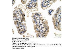 Human Intestine (MCM8 Antikörper  (C-Term))