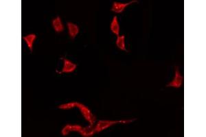 ABIN6274919 staining HeLa by IF/ICC. (BMP3 Antikörper  (Internal Region))