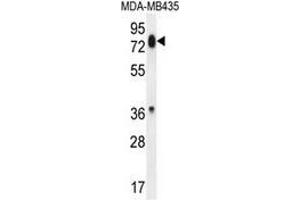Western blot analysis in MDA-MB435 cell line lysates (35ug/lane) using PCDHB13  Antibody .