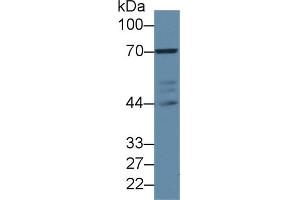 Western blot analysis of Human Jurkat cell lysate, using Rabbit Anti-Mouse LCP2 Antibody (2 µg/ml) and HRP-conjugated Goat Anti-Rabbit antibody (abx400043, 0. (LCP2 Antikörper  (AA 202-463))