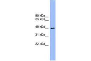 Image no. 1 for anti-ATG3 Autophagy Related 3 (ATG3) (AA 91-140) antibody (ABIN6746545) (ATG3 Antikörper  (AA 91-140))