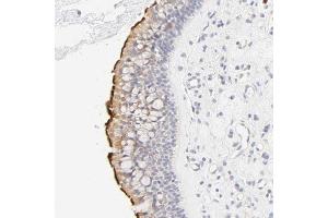 Immunohistochemical staining (Formalin-fixed paraffin-embedded sections) of human nasopharynx shows strong membranous positivity in respiratory epithelial cells. (CYP4B1 Antikörper  (AA 64-186))