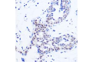 Immunohistochemistry of paraffin-embedded Human breast using SRSF11 Rabbit pAb (ABIN7270215) at dilution of 1:100 (40x lens). (SRSF11 Antikörper)