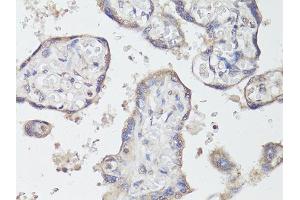Immunohistochemistry of paraffin-embedded human placenta using NTRK2 antibody (ABIN6290695) at dilution of 1:200 (40x lens). (TRKB Antikörper)