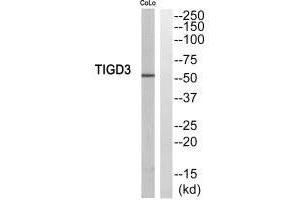 TIGD3 Antikörper  (C-Term)