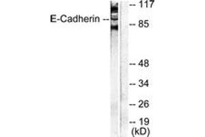 Western blot analysis of extracts from NIH-3T3 cells, using Cadherin-pan Antibody. (Cadherin Antikörper  (AA 833-882))