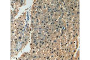 Used in DAB staining on fromalin fixed paraffin- embedded liver tissue (ADCY7 Antikörper  (AA 806-1052))