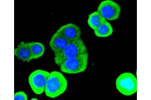 Immunofluorescence analysis of CRC cells using LYZ antibody. (LYZ Antikörper)