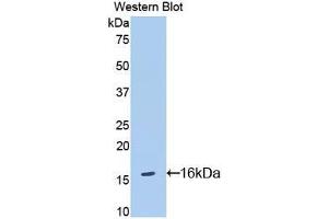 Western blot analysis of the recombinant protein. (IL18R1 Antikörper  (AA 391-518))