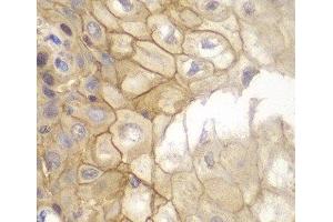 Immunohistochemistry of paraffin-embedded Human esophagus using IL7R Polyclonal Antibody at dilution of 1:100 (40x lens). (IL7R Antikörper)