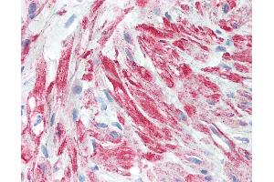 Anti-Beta Actin antibody IHC of human prostate, stroma.