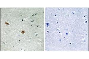 Immunohistochemistry analysis of paraffin-embedded human brain, using Retinoblastoma (Phospho-Ser608) Antibody. (Retinoblastoma Protein (Rb) Antikörper  (pSer608))