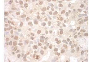 anti-Eyes Absent Homolog 2 (Drosophila) (EYA2) (AA 100-150) antibody