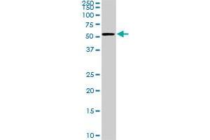 CDK8 monoclonal antibody (M02), clone 6E5. (CDK8 Antikörper  (AA 375-464))