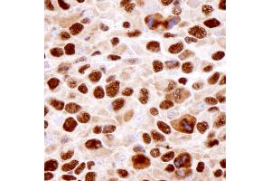 Immunohistochemistry (IHC) image for anti-Heterogeneous Nuclear Ribonucleoprotein K (HNRNPK) (C-Term) antibody (ABIN7448598) (HNRNPK Antikörper  (C-Term))